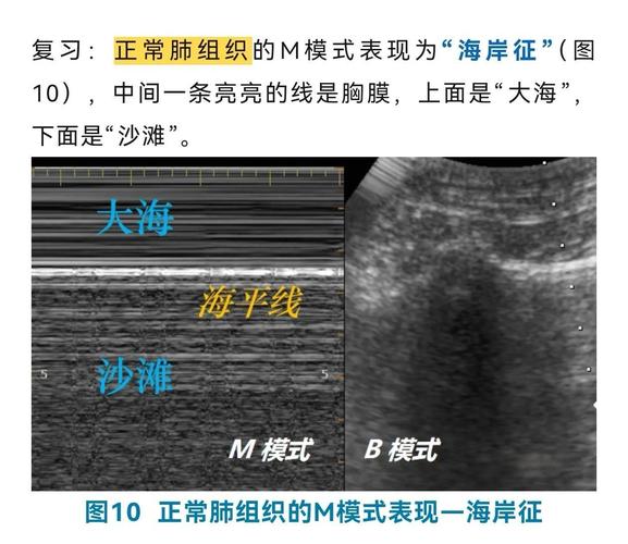 💥Shams:坎宁安被诊断出患有轻度气胸 预计将缺席很长一段时间 💥Shams:坎宁安被诊断出患有轻度气胸 预计将缺席很长一段时间