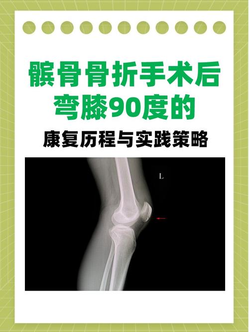 伤病专家浅谈穆迪伤势：有可能髌腱断裂 髌骨脱位 多条韧带损伤